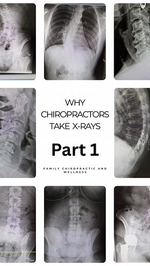 🩻Part 1 : intro of our x-ray series We are going to discuss -the importance of taking X-rays -the process of taking and reviewing X-rays -common diagnosis we see on X-rays -how X-rays help determine your path of care and how educating you will ultimately help you heal better | Family Chiropractic and Wellness