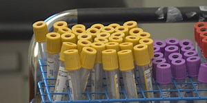 VDH launches new Syphilis dashboard on its website