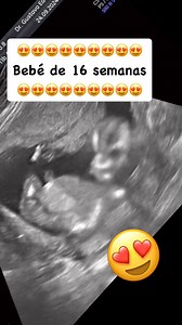 Bebé de 16 semanas | Dr. Gustavo Gonzalez, Ocotlan