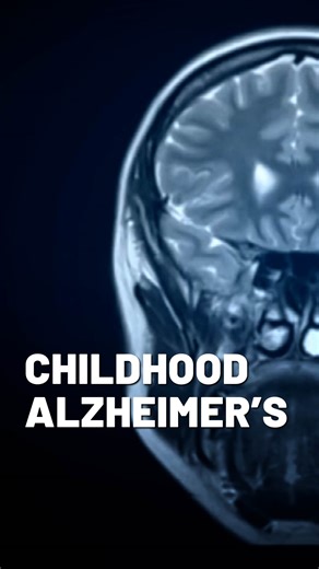 Sanfilippo Syndrome, otherwise known as Childhood Alzheimer’s, is a terminal diagnosis. One family used their diagnosis to drive research for a cure. InvestigateTV share their story today at 3:30 p.m. on WCTV. | WCTV.tv