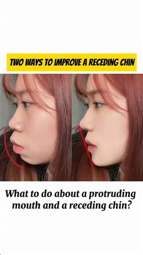 Fix Receding Chin & Get a Sharp Jawline — 2 Simple Moves Daily 😱🔥