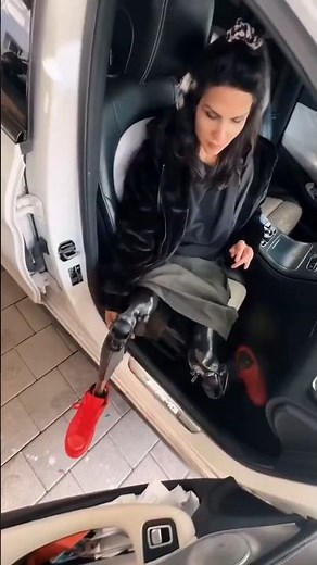 Double Above-Knee Amputee Stuns the World | Dancing, Driving & Living Without LimitsAmazing Prosthet