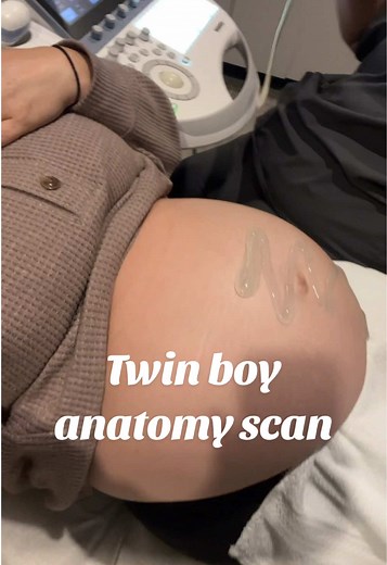I’m #20weeks with the #Twins today, so we had our anatomy scan. It was so crazy to see them both in there, I’m still in shock and still in denial sometimes 😆 #TwinMom #TwinBoys #BoyMom