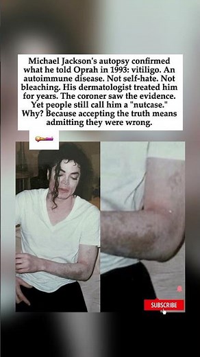 Why Do People STILL Deny Michael Jackson Had Vitiligo?