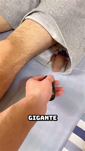 ¡Cucaracha en los Pantalones! 🪳😱