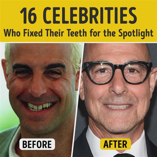 16 Celebrities Who Fixed Their Teeth for the Spotlight | Bright Side