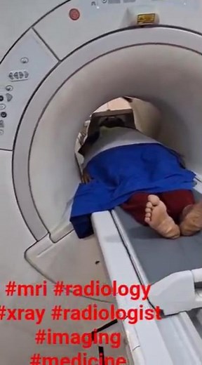 #mri #radiology #xray #radiologist#imaging#medicine #ctscan #medicalimaging #radtech #radiologia #ct