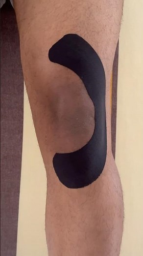 Taping for Patella Dislocation❤️ #kinesiotape #patelladislocation #massage #physio #sportsrehab