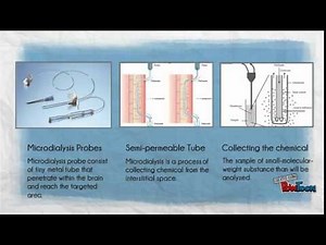 MICRODIALYSIS