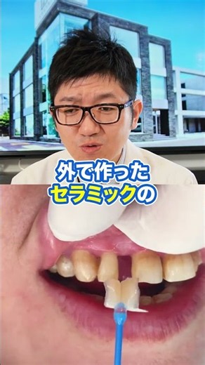 歯と歯の間に隙間…セラミック治療を先生が解説！#shorts