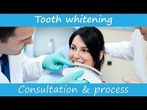 Teeth whitening at the dentist - an example consultation to start professional teeth whitening