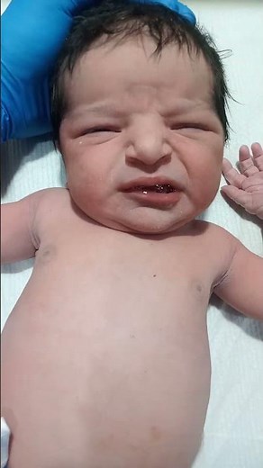 👶 Newborn Baby Umbilical Cord Care & Vitamin K Injection | NICU Male Nurse Protocol