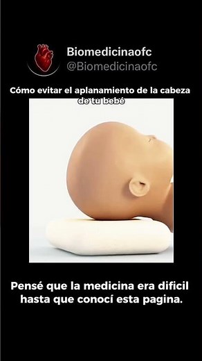 ⚠️ PLAGIOCEFALIA POSICIONAL: CÓMO PREVENIRLA A TIEMPO 🧠