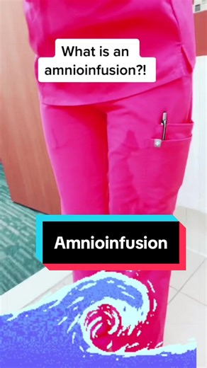 Understanding Amnioinfusion in Labor and Delivery