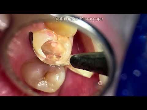 Discovering the Secrets of Teeth: Microscope Exploration Unveiled