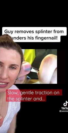 Deep Nail Bed Splinter Removal…Slow Pull