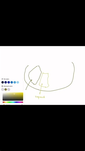 #UpperLimbAnatomy #MedSchool #medtok #medstudentlife #girl