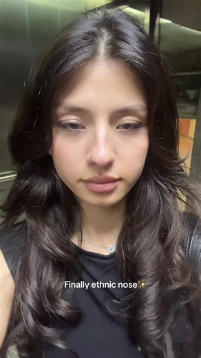 Embracing the Beauty of Ethnic Noses
