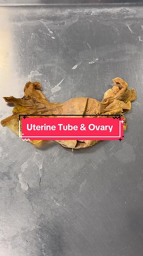 Understanding Uterine Tube and Ovary: Exploring Reproductive Health