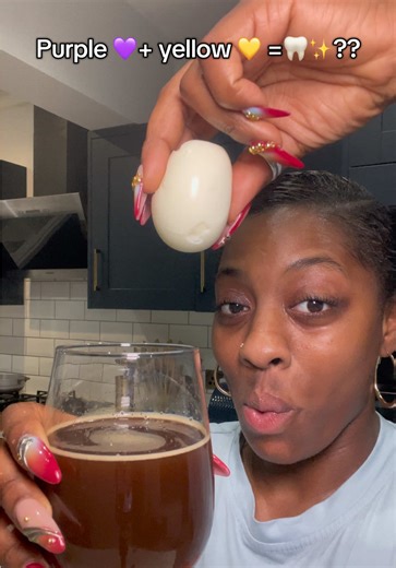 The Truth About Veneers: Are They a Scam?