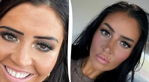 ”Alla tror att jag använt botox – men jag använder den här billiga produkten”