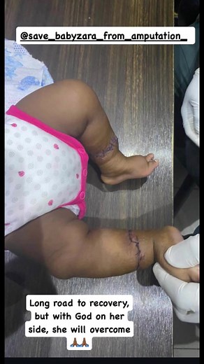Update on Baby Zara: A Journey of Strength and Healing