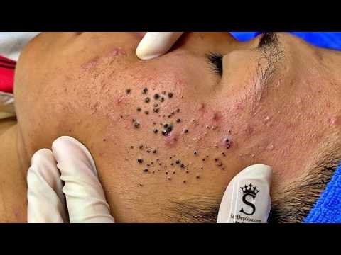 𝑺𝒐𝒐𝒕𝒉𝒊𝒏𝒈 𝑭𝒂𝒄𝒊𝒂𝒍 𝑻𝒓𝒆𝒂𝒕𝒎𝒆𝒏𝒕 𝒇𝒐𝒓 𝑺𝒕𝒓𝒆𝒔𝒔 𝑹𝒆𝒍𝒊𝒆𝒇 | 𝑫𝒆𝒆𝒑 𝑪𝒍𝒆𝒂𝒏𝒊𝒏𝒈 & 𝑪𝒂𝒍𝒎𝒊𝒏𝒈 𝑴𝒂𝒔𝒔𝒂𝒈𝒆 𝒂𝒕 𝑳𝒖𝒙𝒖𝒓𝒚 𝑺𝒑𝒂 #𝟵𝟭𝟴𝟵𝟳𝟲