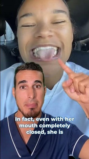 THUMB SUCKING - This happened to her mouth - OPEN BITE