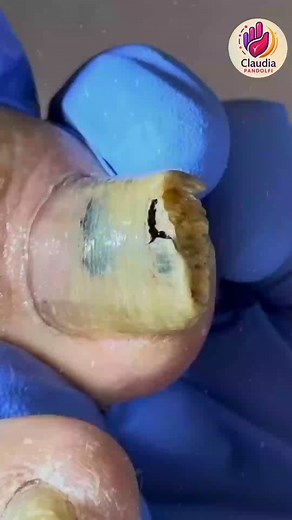 15K views · 95 reactions | Ep.828 Community group portion control and calorie tips  #CalorieControl #HeartHealthyDiet #WellnessLifestyle | Claudia Pandolfi | Facebook