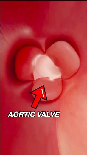 5 clinical signs of aortic regurgitation #usmle #medicalstudent #cardiology #medical #science