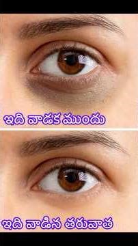 Best Eye -cream Dark Circle cream#viral#trending