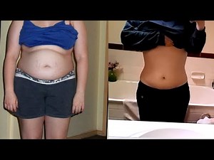 Weight Loss Before & After Photos