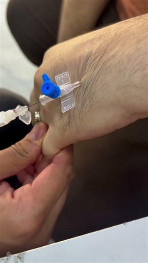 How to Place an IV Catheter 💉 | Quick Nursing Skills #IVCannulation #IVTherapy #Nursing #NurseSkills