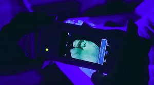 Wound-Scanning Devices