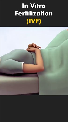 In Vitro Fertilization (IVF) Process