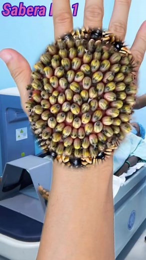 16K views · 90 reactions | Women ASMR video treatment relaxing back side hand removal part 1 #asmrvideo #asmr | Sabera No 1 | Facebook