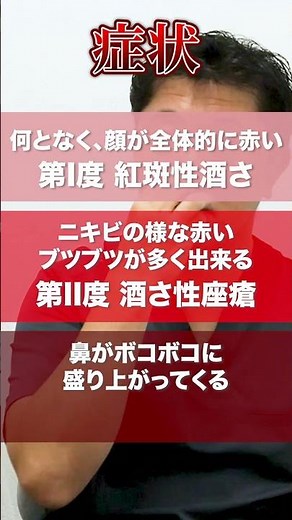 【酒さ】って何！？