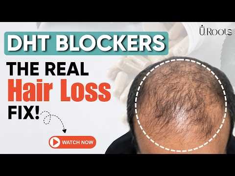 Before You Take DHT Blockers for Hair Loss, Watch This | DHT Blocker | DHT Blocker Supplements 2026