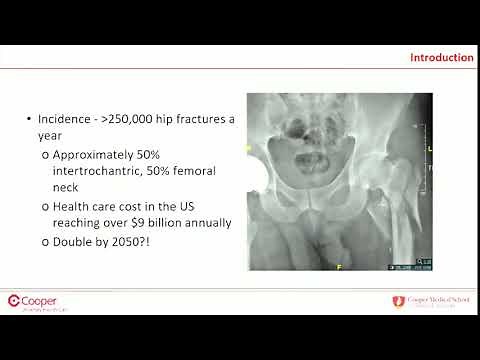 IM nail vs SHS for intertrochanteric femur fractures - debate