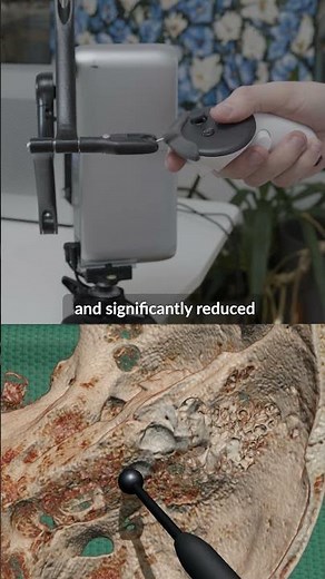 Train Surgeons with Confidence: Haptic-Enabled VR by Haply Robotics