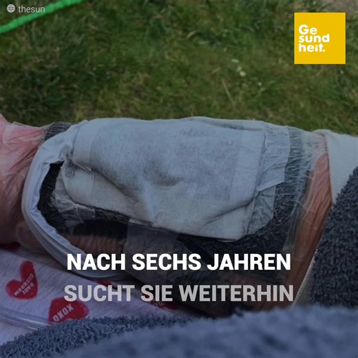 Sharon hat in ihrem Garten Obst gegessen. Als sie einen Biss in ihrer Hand spürte. Zuerst dachte sie, eine Mücke hätte eine Beule hinterlassen. Sie dachte sich nichts dabei. Am nächsten Morgen war ihr Arm geschwollen. Einige Tage später musste sie zur Operation eingeliefert werden. Die Hand sah aus wie aus einem Horrorfilm... | Gesundheit