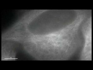 【Cytoskeleton】細胞の中の骨組み