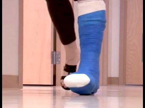 TrueKast with QuickSaw Technology