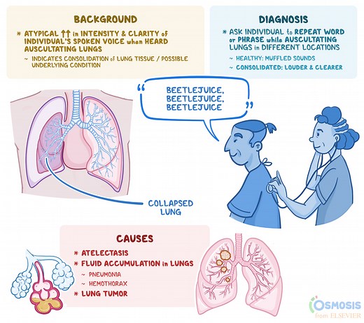 Bronchophony: What Is It, Causes, and More | Osmosis