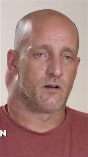 Can Dr. Lee Remove Jason's Dangerous Neck Tumor? | Dr. Pimple Popper | TLC India