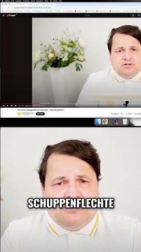 Schuppenflechte-Erfahrung: Kopfhaut-Symptome & Gelenkbefall – Was du wissen musst!