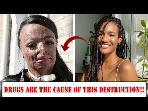 17 Hollywood Stars Destroyed by Addiction – From Fame to Rock Bottom!