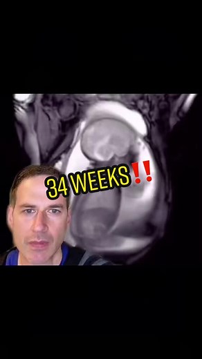 34 Weeks Pregnant Baby Movements and Positioning