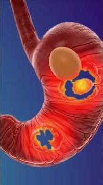 “The Incredible Journey of an Egg Through the Human Body” #digestivesystem #3danatomy #aiart