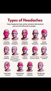 Types of Headache🧐🩺👇👇👇 #healthcare #medical #headaches #healthcare #registerednurse #MedicalEducation #nursing #nurselife | Ma Vickie